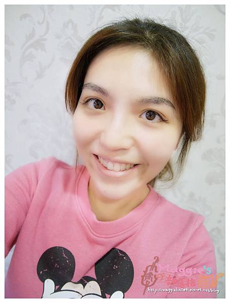 美麗爾縫雙眼皮 (12).JPG