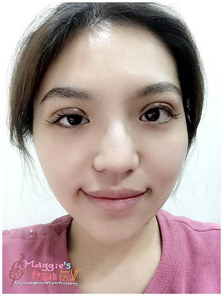 美麗爾縫雙眼皮 (30).jpg