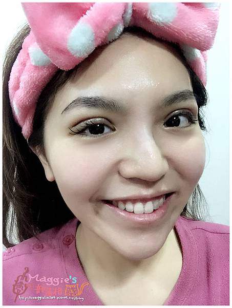 美麗爾縫雙眼皮 (31).jpg