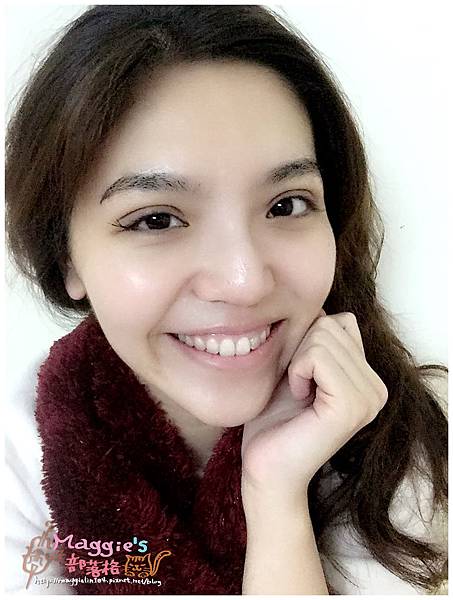 美麗爾縫雙眼皮 (32).jpg