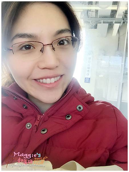 美麗爾縫雙眼皮 (34).JPG