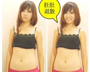 歐萃學聚焦超音波系統