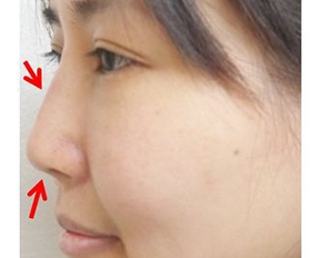 阿芬姐 悄悄的來美鼻!