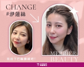 找回了我失散多年的輪廓線