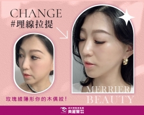 改善嘴邊肉很有感