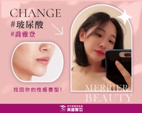 找回唇線讓唇型變更立體