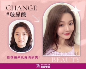 微微一笑很傾城，原來因為蘋果肌