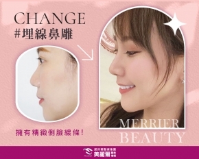凱莉絲線雕美鼻~簡單擁有完美側臉