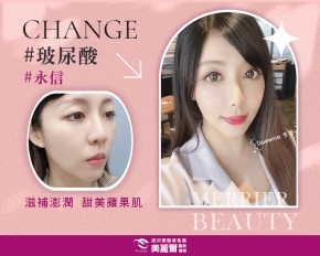 擺脫命苦臉!擁有自然澎潤蘋果肌~