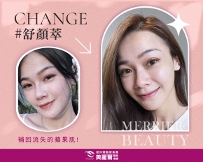 親和甜姐兒!找回澎潤蘋果肌