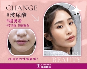 精緻自然嘟嘟唇~偷偷變美麗