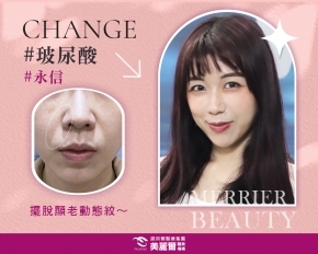 濾鏡Say No!擺脫顯老法令紋