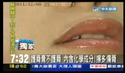中天新聞 陳美齡醫師-唇膏女王唇裂破皮 低疼痛含麻藥玻尿酸終結百支唇膏