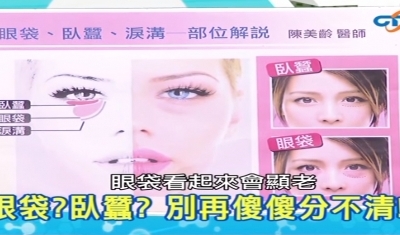 【中視健康加油站】陳美齡醫師-鬆垮眼袋我不愛