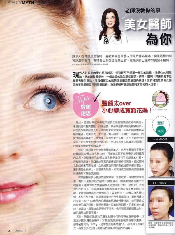 豐額 豐頰 自體脂防移植 玻尿酸 微晶瓷