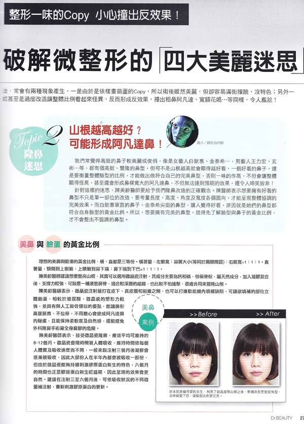 微整形 美麗迷思 山根 隆鼻 玻尿酸 微晶瓷