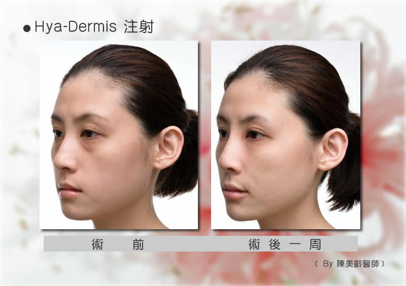 水微晶
