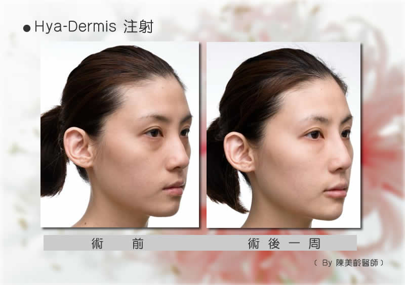 水微晶
