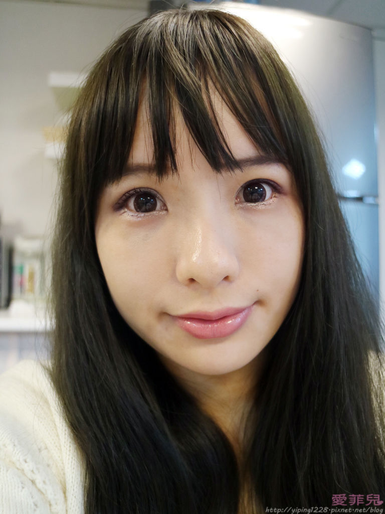 豐唇/補淚溝/美麗爾